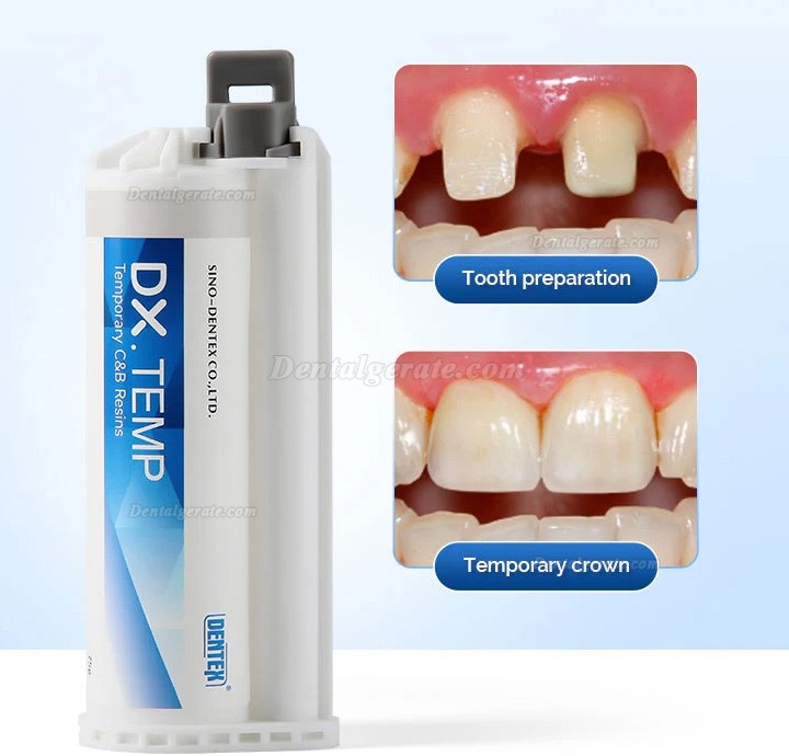 Dental Provisorische Kronen- und Br&uuml;ckenmaterialien A1 / A2 / A3 mit 10 Mischkan&uuml;len